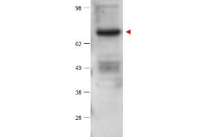 Image no. 1 for anti-Protein Kinase C, beta (PRKCB) (Internal Region) antibody (ABIN401432) (PKC beta 抗体  (Internal Region))