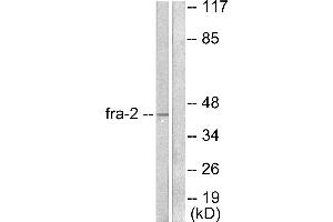 Western blot analysis of extracts from LOVO cells, using Fra-2 antibody (#C0197). (FOSL2 抗体)