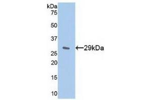Detection of Recombinant IkBe, Human using Polyclonal Antibody to Inhibitory Subunit Of NF Kappa B Epsilon (IkBe)