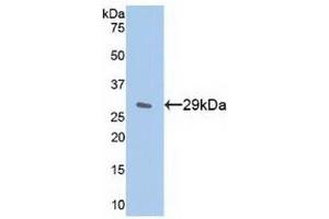 Detection of Recombinant IkBe, Human using Polyclonal Antibody to Inhibitory Subunit Of NF Kappa B Epsilon (IkBe) (Inhibitory Subunit of NF-KappaB epsilon (AA 207-440) 抗体)
