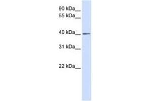 Image no. 1 for anti-NK3 Homeobox 2 (NKX3-2) (AA 180-229) antibody (ABIN6741422) (NKX3-2 抗体  (AA 180-229))