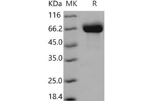 Western Blotting (WB) image for Butyrylcholinesterase (BCHE) (Active) protein (His tag) (ABIN7194451) (Butyrylcholinesterase Protein (BCHE) (His tag))