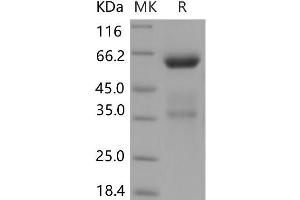 Western Blotting (WB) image for C-Type Lectin Domain Family 10, Member A (CLEC10A) protein (Fc Tag) (ABIN7194472) (CLEC10A Protein (Fc Tag))
