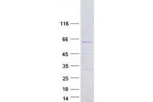 Validation with Western Blot