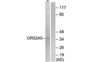 Western Blotting (WB) image for anti-Olfactory Receptor 52A5 (OR52A5) (AA 160-209) antibody (ABIN2891125) (OR52A5 抗体  (AA 160-209))