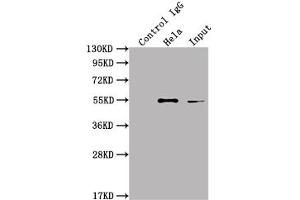 Immunoprecipitating ILK in Hela whole cell lysate Lane 1: Rabbit control IgG instead of ABIN7127572 in Hela whole cell lysate. (Recombinant ILK 抗体)