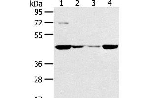 Western Blot analysis of HT-29, 231, hela and A549 cell using SMYD5 Polyclonal Antibody at dilution of 1:200 (SMYD5 抗体)