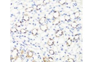 Immunohistochemistry of paraffin-embedded Mouse kidney using SS18L1 Polyclonal Antibody at dilution of 1:100 (40x lens). (SS18L1 抗体)
