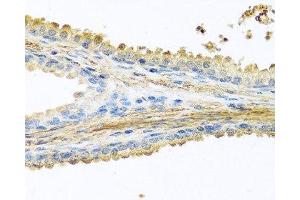 Immunohistochemistry of paraffin-embedded Human prostate using PIP Polyclonal Antibody at dilution of 1:100 (40x lens). (PIP 抗体)