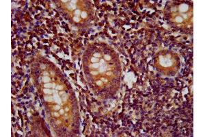 IHC image of ABIN7178015 diluted at 1:500 and staining in paraffin-embedded human appendix tissue performed on a Leica BondTM system. (WDR37 抗体  (AA 1-496))