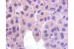 IHC analysis of paraffin-embedded mouse liver tissue, using Myoglobin antibody (1/100 dilution). (Myoglobin 抗体  (AA 2-154))