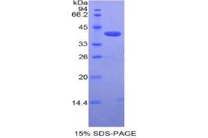 SDS-PAGE analysis of Mouse SIGIRR Protein.