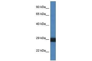 Western Blot showing CTSG antibody used at a concentration of 1 ug/ml against THP-1 Cell Lysate (Cathepsin G 抗体  (C-Term))