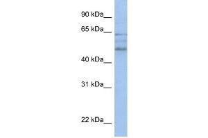 WB Suggested Anti-ZMYND17 Antibody Titration:  0. (ZMYND17 抗体  (C-Term))
