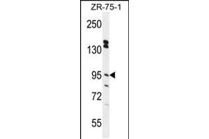 Western blot analysis in ZR-75-1 cell line lysates (35ug/lane). (ERMP1 抗体  (C-Term))