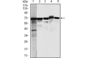 Western Blotting (WB) image for anti-Moesin (MSN) antibody (ABIN1844415) (Moesin 抗体)