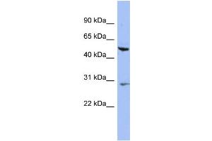 WB Suggested Anti-KRT75 Antibody Titration: 0. (Keratin 75 抗体  (N-Term))