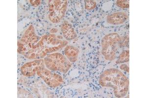 Used in DAB staining on fromalin fixed paraffin- embedded kidney tissue (SP140 抗体  (AA 443-655))