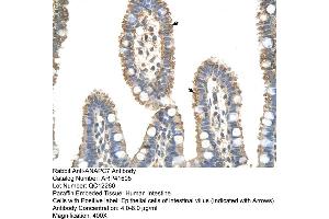 Rabbit Anti-ANAPC7 Antibody  Paraffin Embedded Tissue: Human Intestine Cellular Data: Epithelial cells of intestinal villas Antibody Concentration: 4. (ANAPC7 抗体  (C-Term))