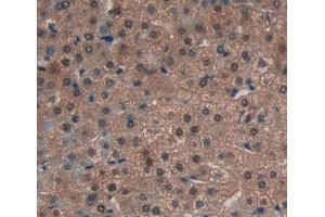 Used in DAB staining on fromalin fixed paraffin- embedded liver tissue (Atrophin 1 抗体  (AA 879-1190))