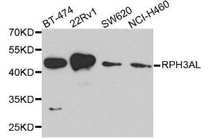 Western blot analysis of extracts of various cell lines, using RPH3AL antibody. (RPH3AL 抗体  (AA 161-315))