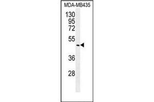 Western blot analysis of BMP14 / GDF5 Antibody (C-term) in MDA-MB435 cell line lysates (35ug/lane). (GDF5 抗体  (C-Term))