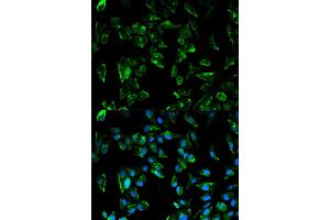 Immunofluorescence analysis of HeLa cells using TPM3 antibody (ABIN5970548). (TPM3 抗体)