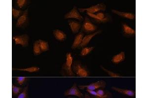 Immunofluorescence analysis of U-2 OS cells using PDE6D Polyclonal Antibody at dilution of 1:100 (40x lens). (PDE6D 抗体)
