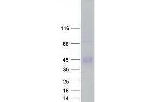 ZPBP2 Protein (Transcript Variant 2) (Myc-DYKDDDDK Tag)