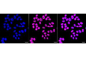 Immunocytochemical staining of HepG2 cells with Histone H2B (formyl K120) antibody (ABIN7798948), 1:1,000). (Recombinant Histone H2B 抗体  (H2BK120fo))