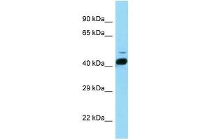 WB Suggested Anti-Rorb Antibody   Titration: 1. (RORB 抗体  (N-Term))