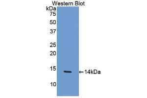 Western blot analysis of the recombinant protein. (CCL4 抗体  (AA 24-92))
