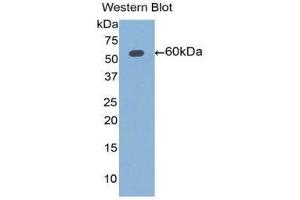 Western Blotting (WB) image for anti-Aldehyde Dehydrogenase 7 Family, Member A1 (ALDH7A1) (AA 1-539) antibody (ABIN1077759)