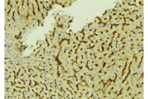 ABIN6276661 at 1/100 staining Mouse liver tissue by IHC-P. (CETP 抗体)