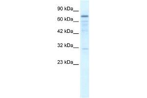 WB Suggested Anti-FLJ20244 Antibody Titration:  2.