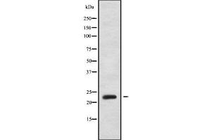 Western blot analysis of PPP1R2P3 using MCF7 whole cell lysates (PPP1R2P3 抗体)