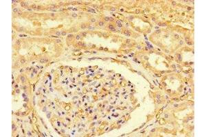 Immunohistochemistry of paraffin-embedded human kidney tissue using ABIN7174143 at dilution of 1:100 (ZRSR2P1 (AA 197-372) 抗体)