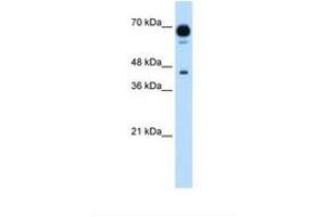 Image no. 1 for anti-Pseudouridylate Synthase 7 Homolog (PUS7) (AA 101-150) antibody (ABIN341308) (PUS7 抗体  (AA 101-150))