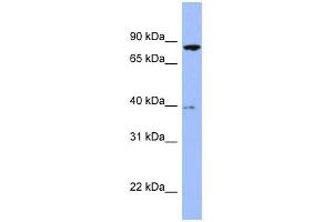 WB Suggested Anti-RDX Antibody Titration: 0. (Radixin 抗体  (Middle Region))