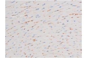 ABIN6267603 at 1/200 staining Mouse heart tissue sections by IHC-P. (PKC theta 抗体  (pSer676))