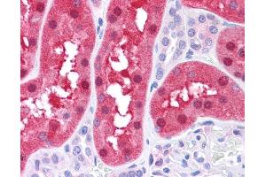 FAH antibody was used for immunohistochemistry at a concentration of 4-8 ug/ml. (FAH 抗体)
