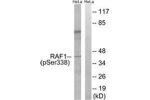 Western blot analysis of extracts from HeLa cells treated with paclitaxel 1uM 24h, using C-RAF (Phospho-Ser338) Antibody. (RAF1 抗体  (pSer338))