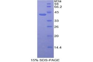 SDS-PAGE analysis of Human ACVR2A Protein. (ACVR2A 蛋白)