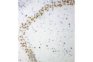 Anti-53BP1 antibody, IHC(P) IHC(P): Mouse Brain Tissue