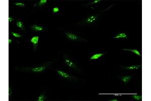 Immunofluorescence of purified MaxPab antibody to IFRD2 on HeLa cell. (IFRD2 抗体  (AA 1-442))