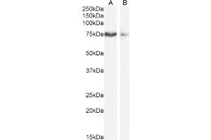 ABIN570800 (1µg/ml) staining of HEK293 (A) and A431 (B) cell lysate (35µg protein in RIPA buffer). (SLCO1B3 抗体  (Internal Region))