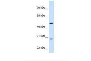 Image no. 1 for anti-Enoyl CoA Hydratase, Short Chain, 1, Mitochondrial (ECHS1) (C-Term) antibody (ABIN320976)
