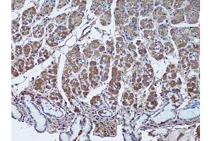 Immunohistochemistry of paraffin-embedded human stomach using SFRP1 antibody (ABIN1682675, ABIN1682676, ABIN5664178 and ABIN6219906) at dilution of 1:50 (20x lens). (SFRP1 抗体  (AA 30-314))