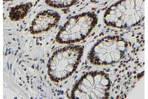 Immunohistochemistry (IHC) image for anti-B-Cell CLL/lymphoma 2 (BCL2) (pSer87) antibody (ABIN6256440)