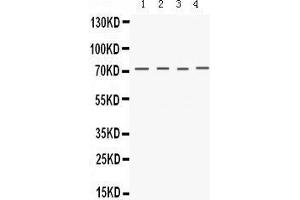 Western Blotting (WB) image for anti-Potassium Voltage-Gated Channel, Shaker-Related Subfamily, Member 4 (KCNA4) (AA 609-647), (C-Term) antibody (ABIN3043264) (Kv1.4 抗体  (C-Term))